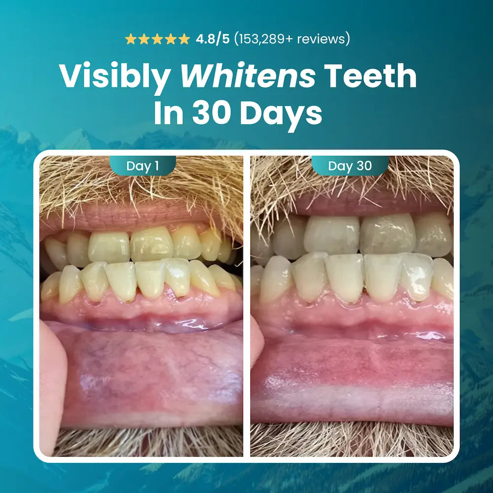 OzziHome™️ - Remineralizing Gum